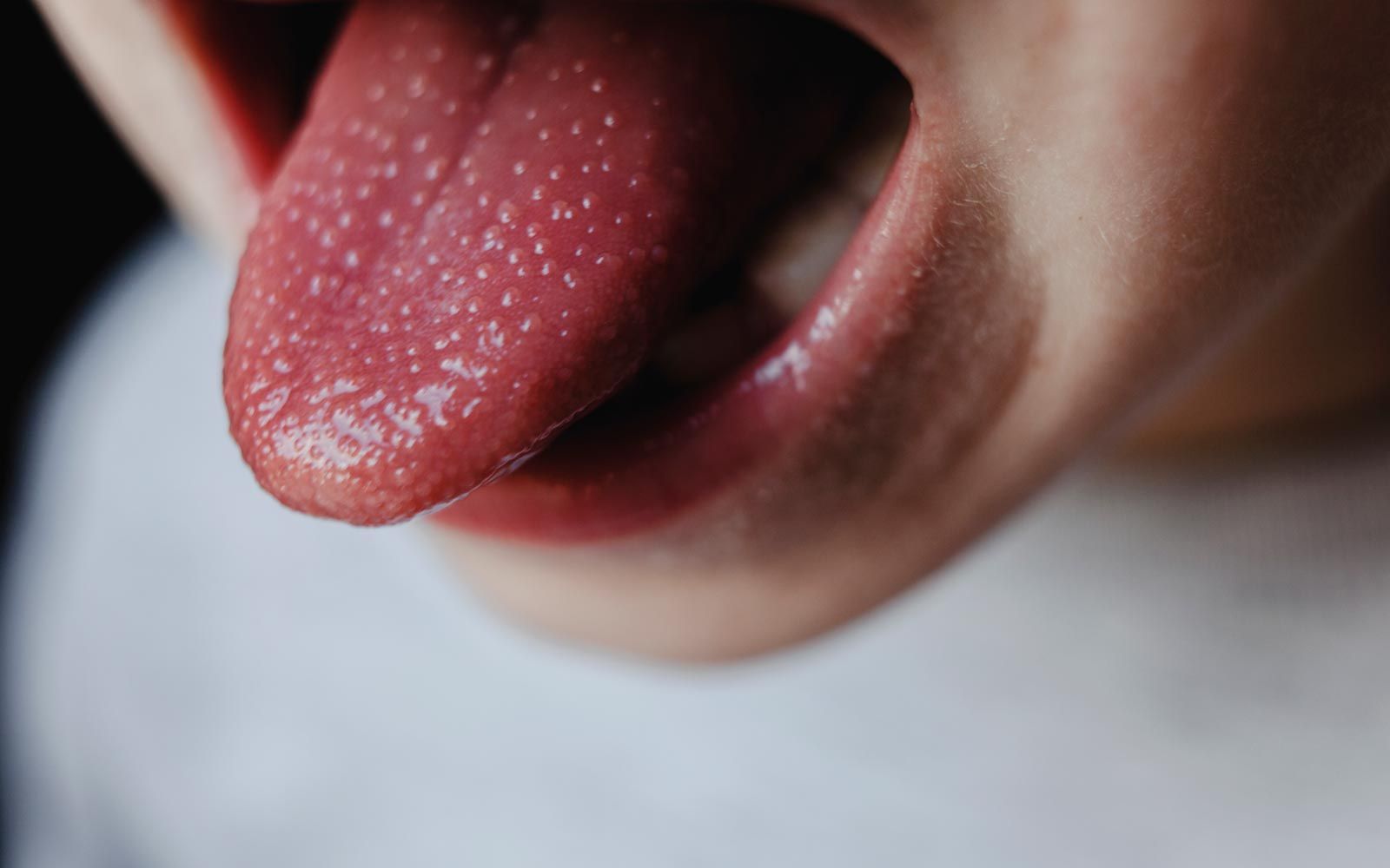 Nærbilde av et barn som strekker ut tungen som ligner på "bringebærtunge"