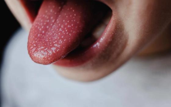 Skarlagensfeber Skarlagensfeber