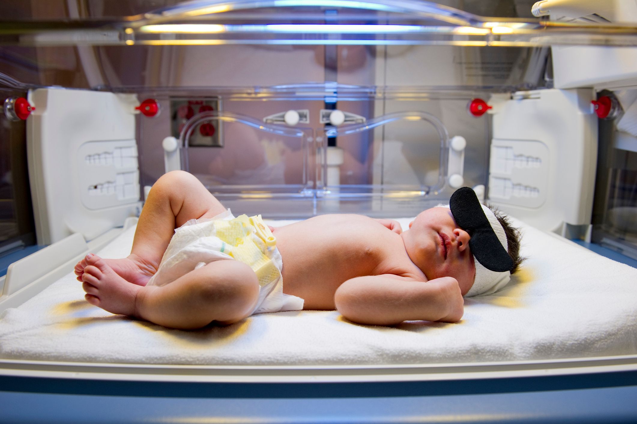 En baby er i en kuvøse og får lysbehandling