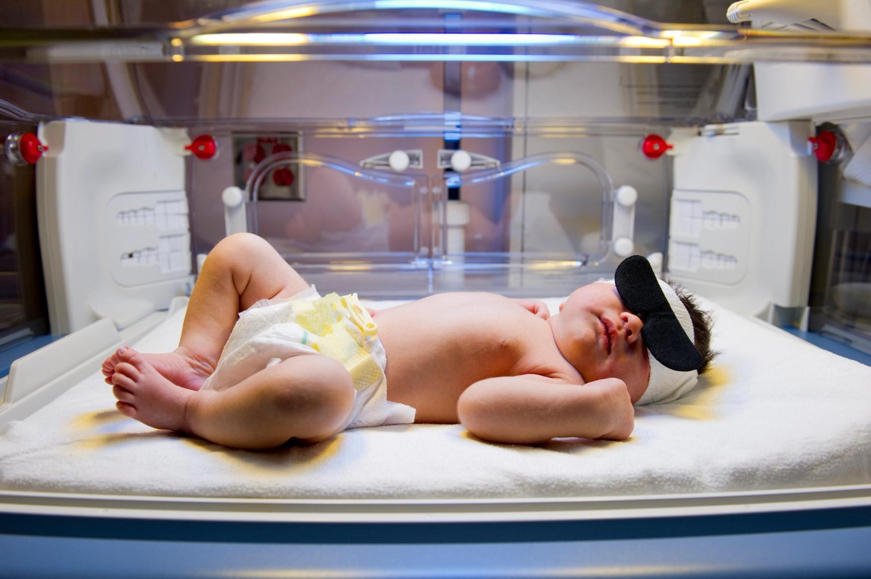En baby er i en kuvøse og får lysbehandling