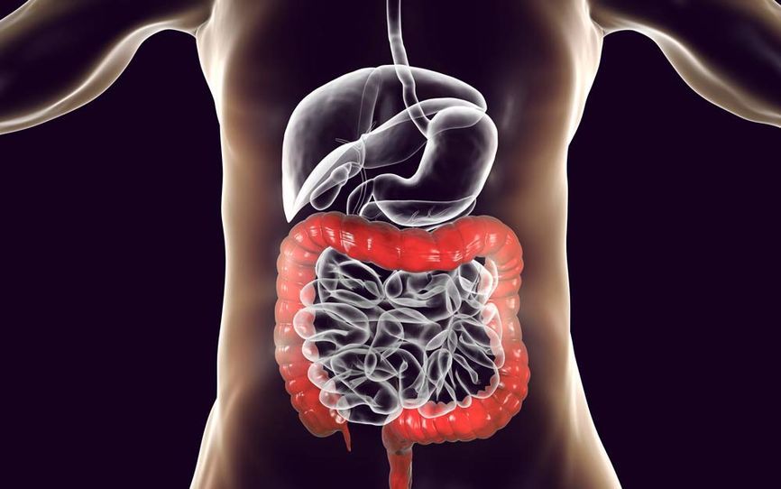 Tarmkreft og tykktarmskreft