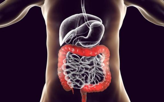 Tarmkreft og tykktarmskreft