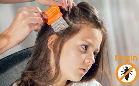 Det er tid for lusesjekk! Det er tid for lusesjekk!