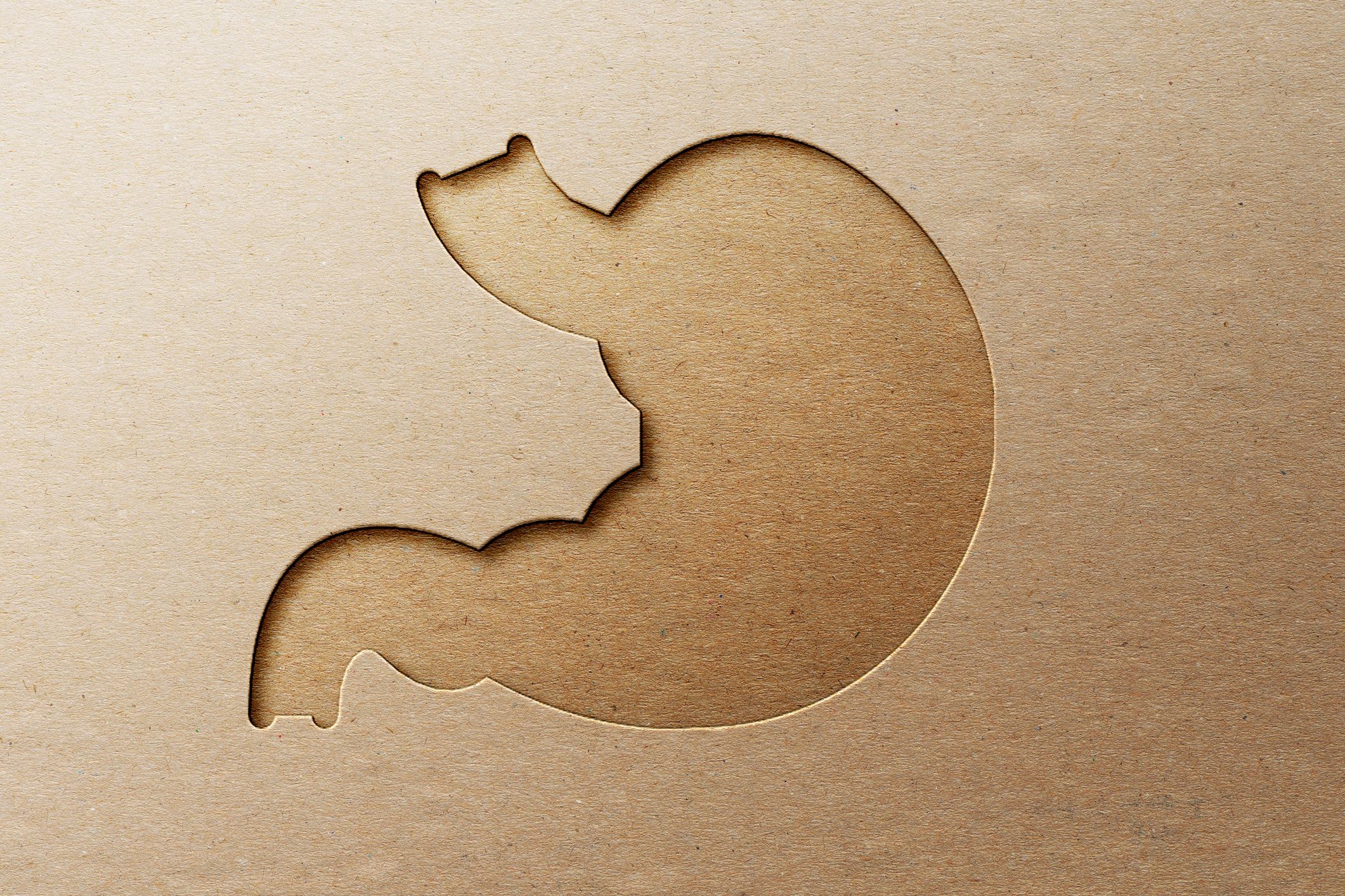 Plages du av halsbrann og sure oppstøt?