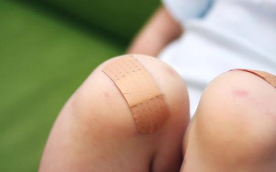 Skrubbsår Skrubbsår