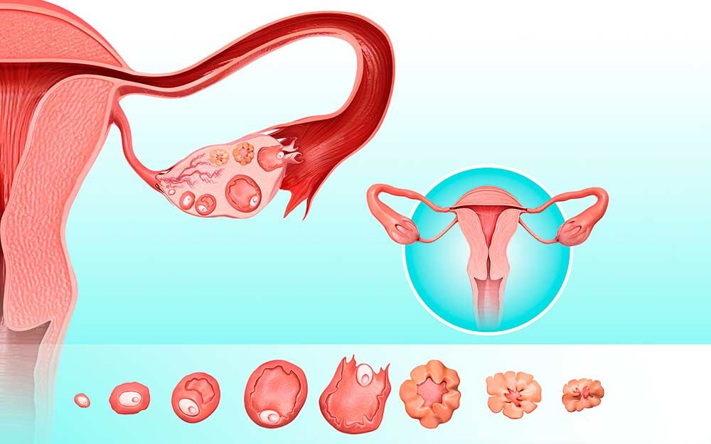 Illustrasjon av kvinnens reproduktive system og eggløsning, som viser eggstokken med ulike stadier av follikkelutvikling frem til eggløsning og dannelse av det gule legeme (corpus luteum).