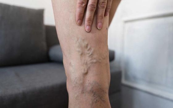 Åreknuter Åreknuter