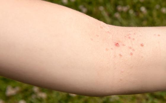 Mollusker barn Mollusker barn