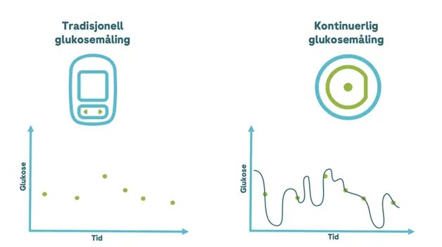 Illustrasjon som viser blodsukkerkurve