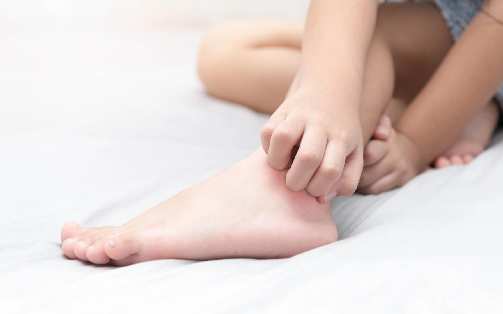 Barn som klør seg på foten