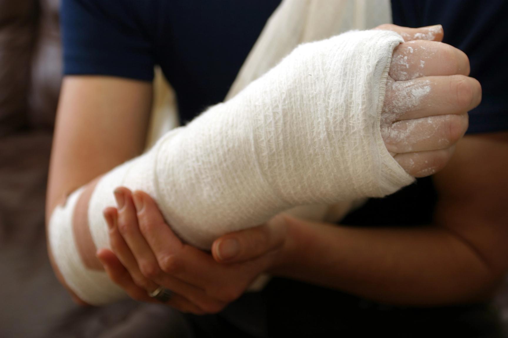Brukket arm med gips