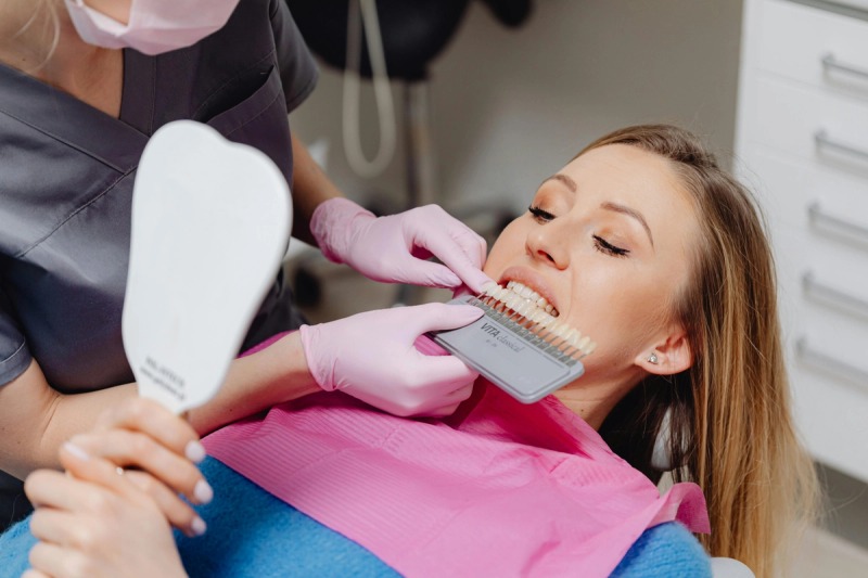 Dental Veneers