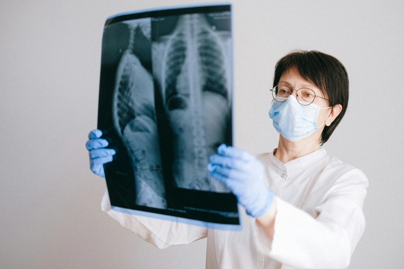 X-Ray Imaging