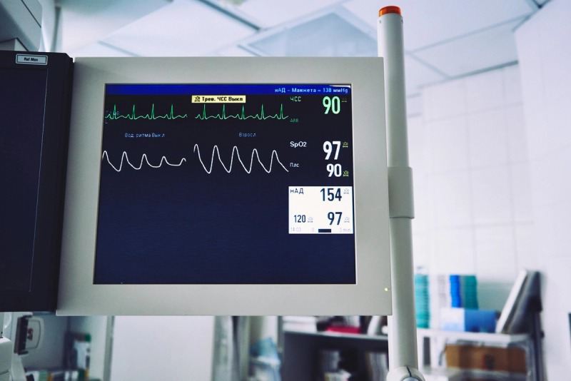 ECG / EKG