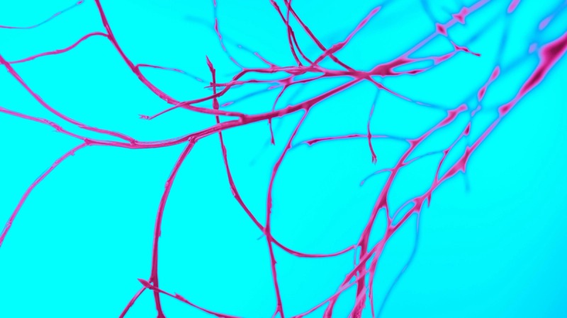 Angiography
