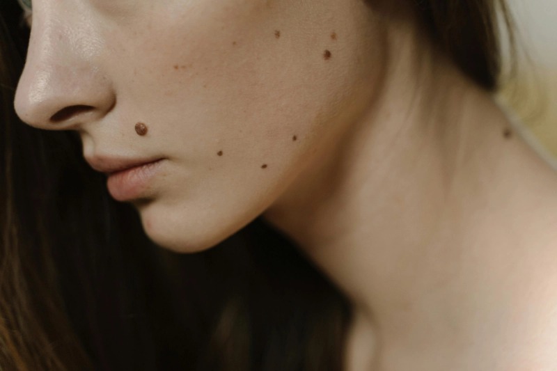 Mole and Skin Lesion Check