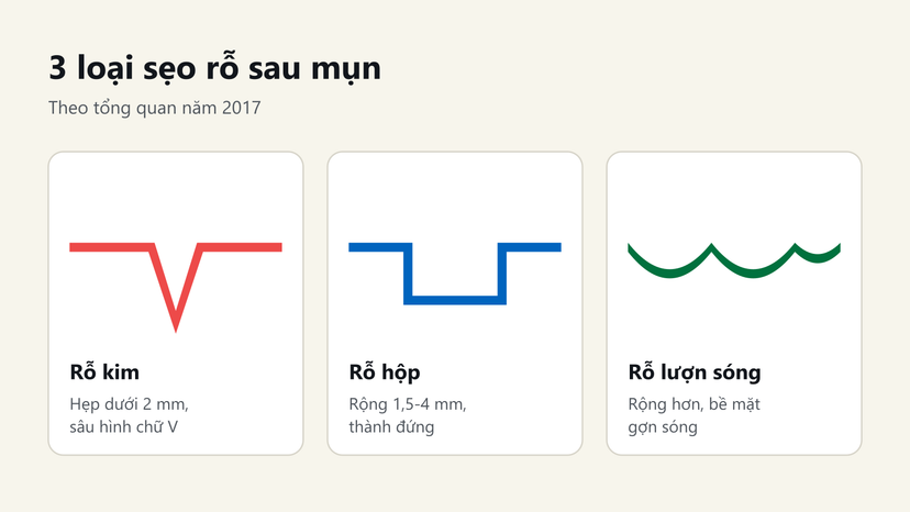 Đồ hoạ 3 loại sẹo rỗ: rỗ kim hình chữ V, rỗ hộp thành đứng, rỗ lượn sóng