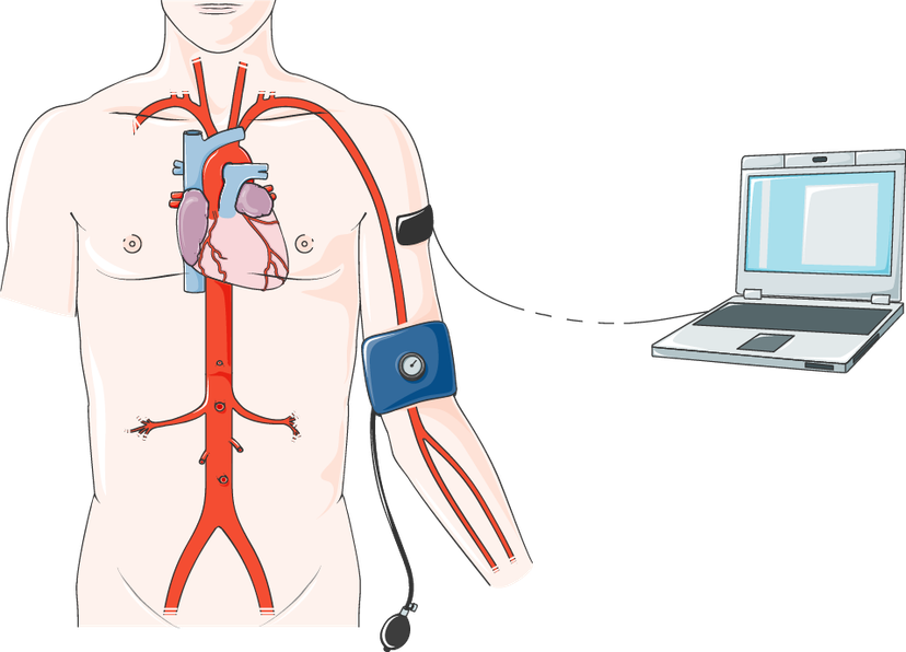 Hình minh hoạ đo huyết áp bằng máy có vòng bít quấn quanh bắp tay