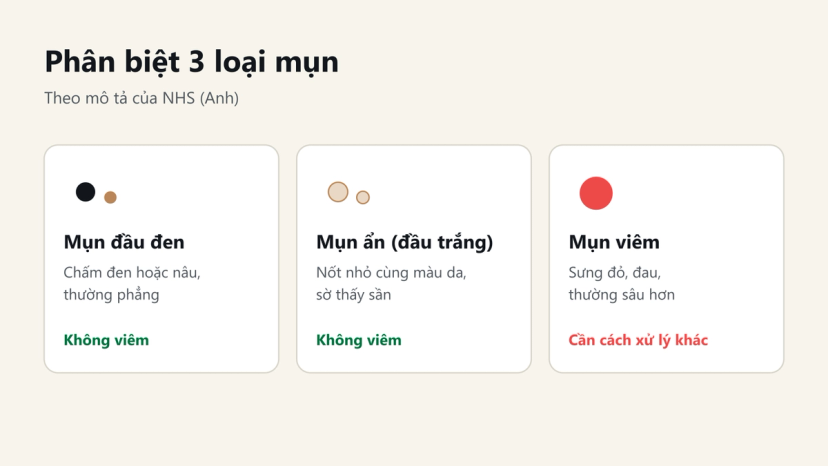 Đồ hoạ phân biệt mụn đầu đen, mụn ẩn (đầu trắng) và mụn viêm theo NHS