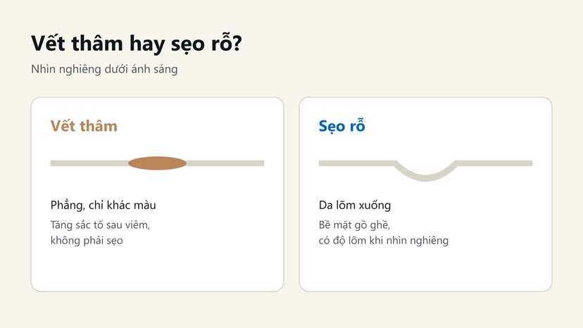 Đồ hoạ phân biệt vết thâm phẳng chỉ khác màu với sẹo rỗ làm da lõm xuống