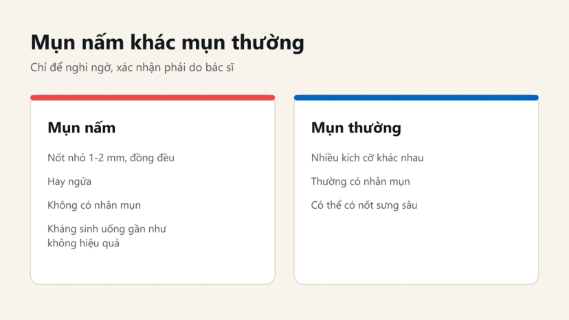 Đồ hoạ so sánh mụn nấm và mụn thường: kích thước nốt, ngứa, nhân mụn