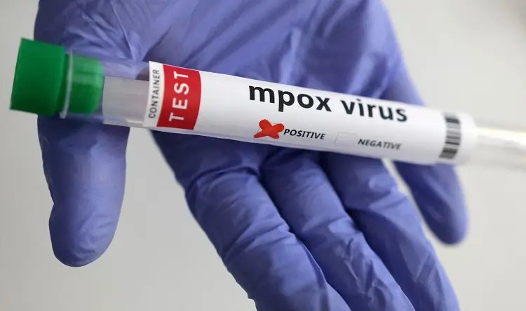 Image for Britain detects two more cases of new mpox variant