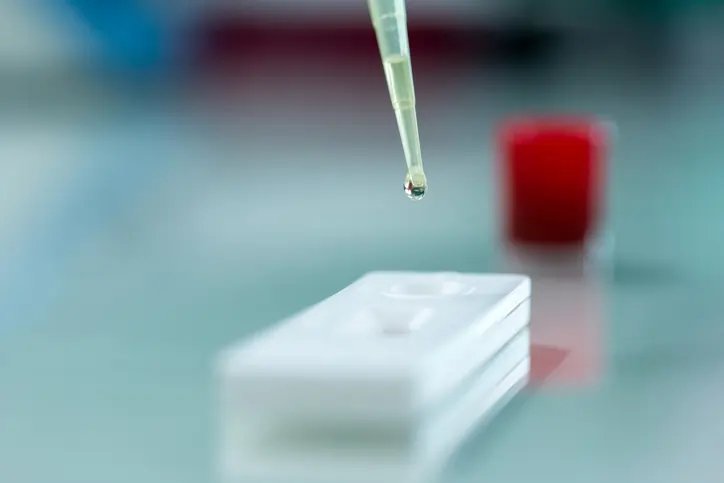 Lateral Flow Assay Market to Expand at 5.1% CAGR, Surpassing $14,844.6 Million by 2034 - Research Reports news and analysis from Global Banking & Finance Review