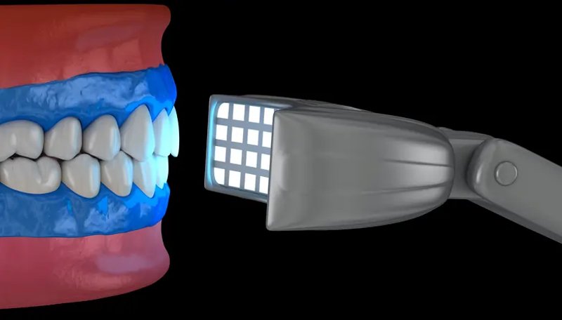 Image for Dental Curing Lights Market to Reach USD 765.8 Million by 2034, Expanding at 5.8% CAGR