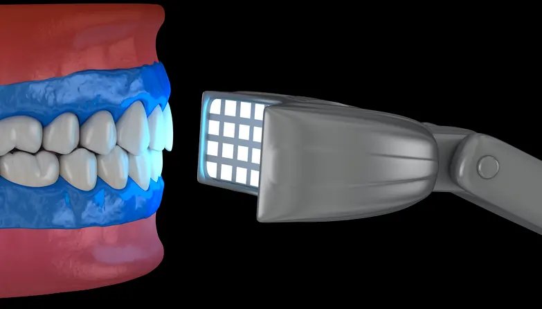 Image for Dental Curing Lights Market to Reach USD 765.8 Million by 2034, Expanding at 5.8% CAGR