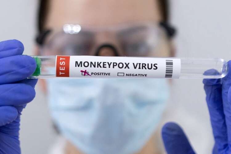 Test tubes labeled with monkeypox virus positive results - Global Banking & Finance Review