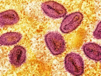 Image for Almost 30,000 suspected mpox cases in Africa this year, WHO says