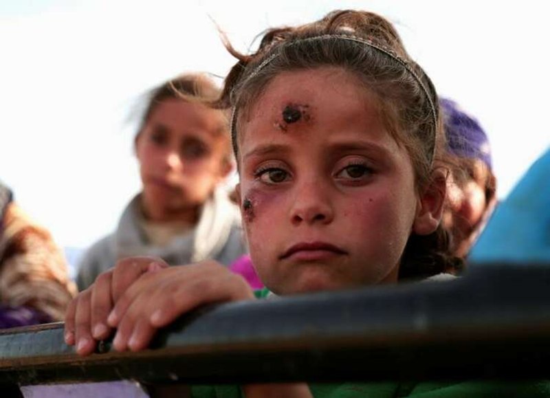 Image for U.N. says UK aid cuts likely to cause thousands of needless deaths