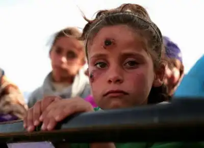 Image for U.N. says UK aid cuts likely to cause thousands of needless deaths