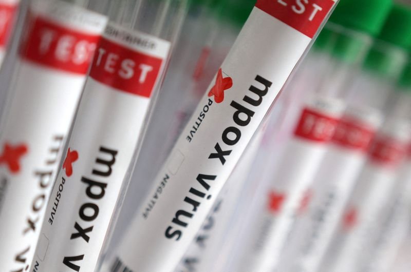 Image for France identifies first case of new mpox variant, AFP reports