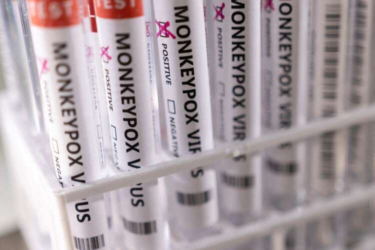 Test tubes labeled with 'Monkeypox virus positive' related to WHO's emergency decision - Global Banking & Finance Review