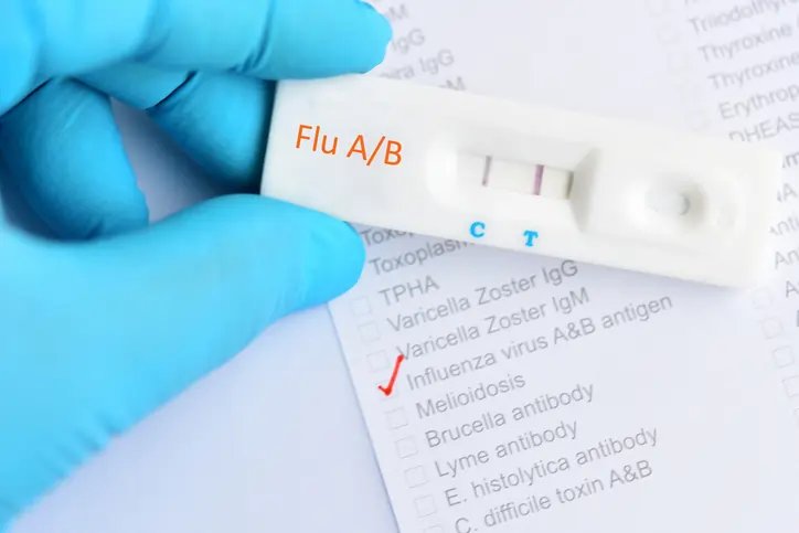 Influenza Diagnostic Market to Reach USD 3.34 Billion by 2034 | Fact.MR Report - Research Reports news and analysis from Global Banking & Finance Review