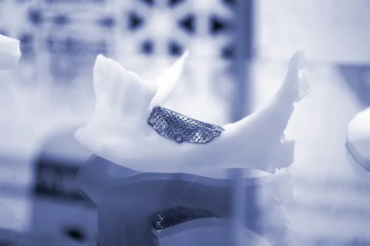 Image for Facial Implant Market is Projected to Reach $1.83 Billion by 2034 Amidst Rising Demand for Aesthetic Enhancements | Fact.MR Report