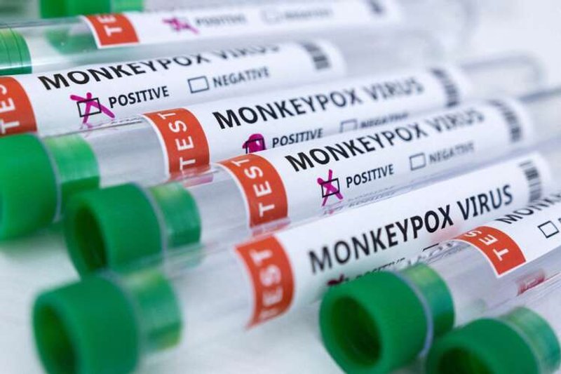 Image for EU signs deal with Bavarian Nordic for supply of 110,000 monkeypox vaccines