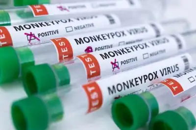Image for EU signs deal with Bavarian Nordic for supply of 110,000 monkeypox vaccines