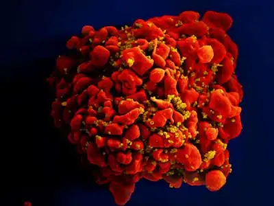 Image for Oldest patient yet cured of HIV after stem cell transplant – researchers