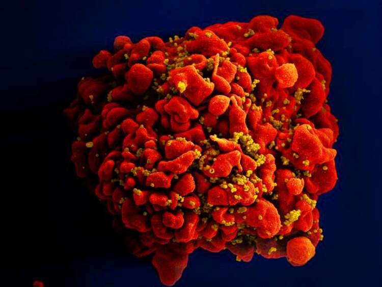 Image for Oldest patient yet cured of HIV after stem cell transplant – researchers