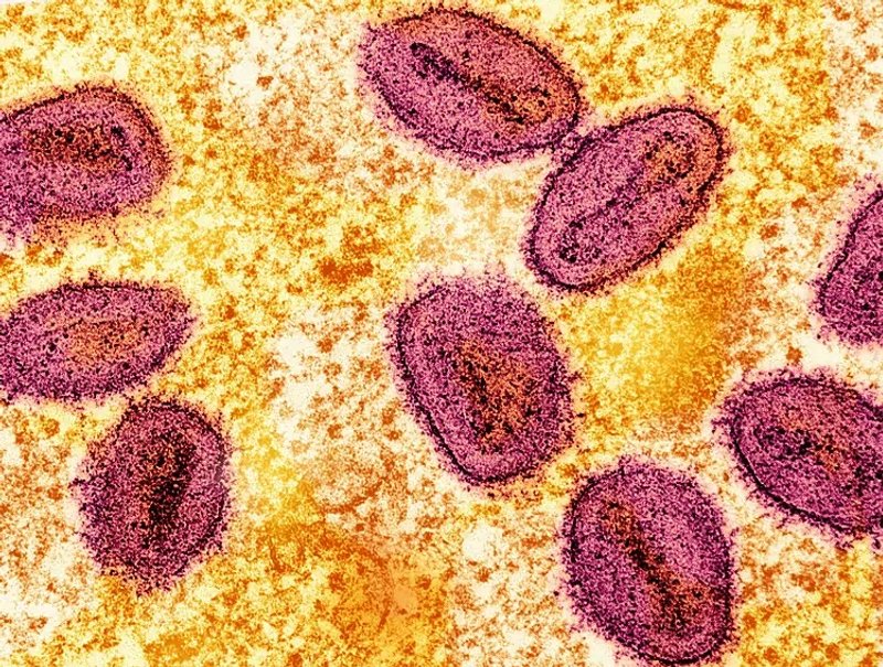 Image for Philippines detects first mpox case this year, yet to determine strain