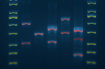 DNA Digest