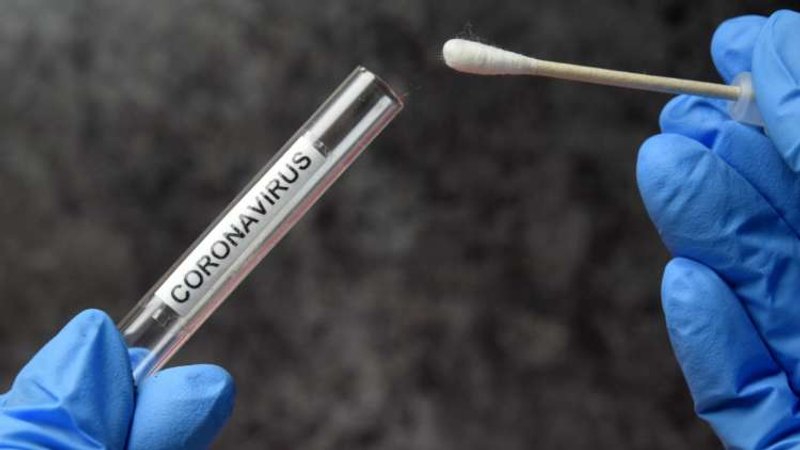 Image for Covid testing in the workplace – what do employers need to know?