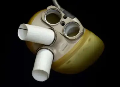 Image for Artificial heart maker Carmat completes 7 million euro capital increase