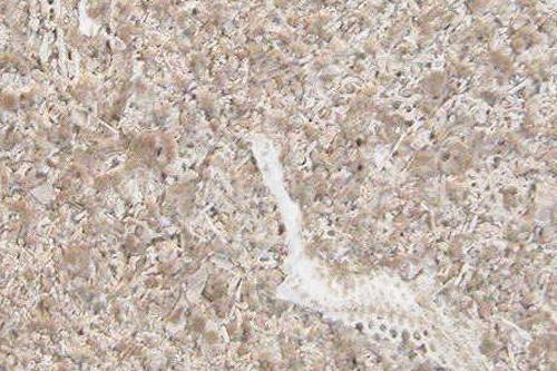 Đá Indiana Limestone — Mỹ, ảnh bề mặt