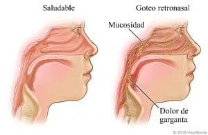 Otorrinolaringólogo en Guadalajara - Oídos, Nariz, Garganta y Voz, - Dr. Gerardo López Guerra, ORL y CCC, FACS.
