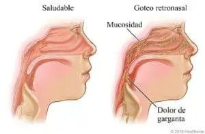 Otorrinolaringólogo en Guadalajara - Oídos, Nariz, Garganta y Voz, - Dr. Gerardo López Guerra, ORL y CCC, FACS.