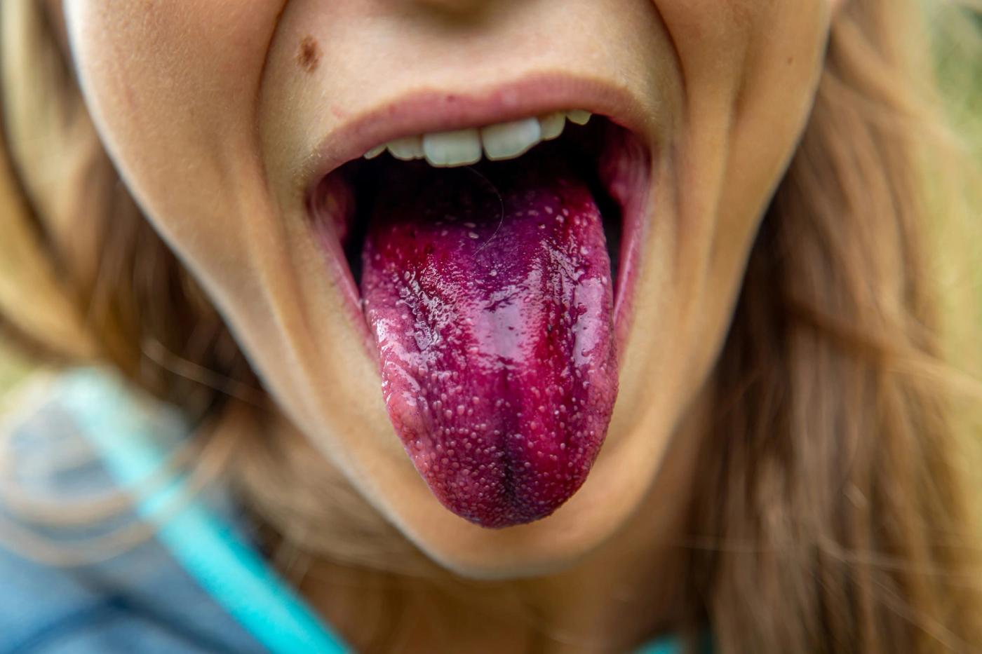 Why Your Sense of Taste Is Unlike Anyone Else's on Earth