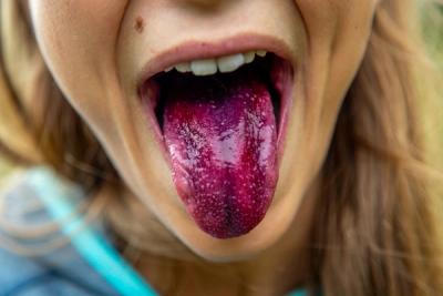 Why Your Sense of Taste Is Unlike Anyone Else's on Earth